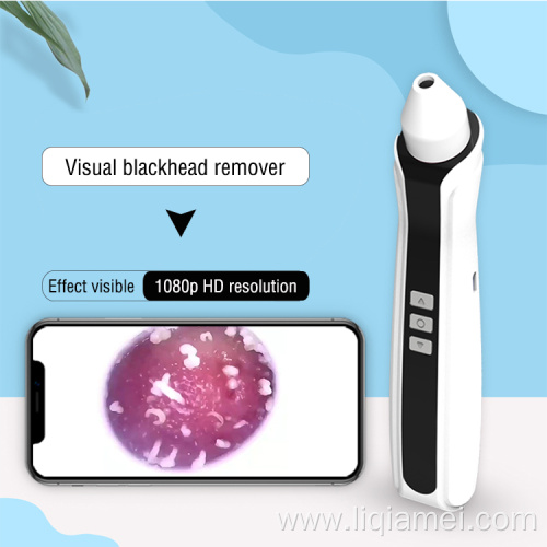 Rechargeable Battery Blackhead Remover Instrument
